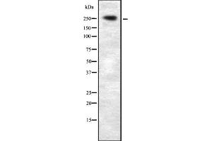 Western blot analysis of PLCE1 expression in HEK293 cells ,The lane on the left is treated with the antigen-specific peptide. (PLCE1 Antikörper)