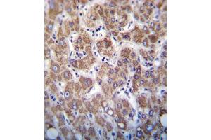 OC2 Antibody (Center) 7796c immunohistochemistry analysis in formalin fixed and paraffin embedded human liver tissue followed by peroxidase conjugation of the secondary antibody and DAB staining. (Apolipoprotein C-II Antikörper  (AA 45-73))