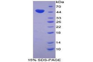 SDS-PAGE analysis of Cow Chromogranin B Protein.