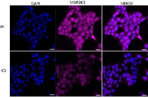 Immunocytochemical staining of HeLa cells using MAP2K3 antibody (ABIN7799465), 1:1,000), Top panel: wild-type (WT), Bottom panal: MAP2K3 shRNA knockdown (KD).