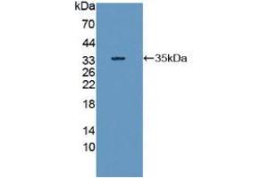 Figure. (RIPK1 Antikörper  (AA 17-289))