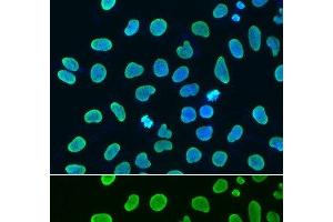 Immunofluorescence analysis of HeLa cells using Acetyl-Histone H4-K8 Polyclonal Antibody (Histone H4 Antikörper  (acLys8))