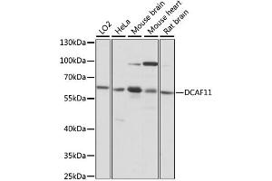 Western blot analysis of extracts of various cell lines, using DCAF11 antibody. (DCAF11 Antikörper)