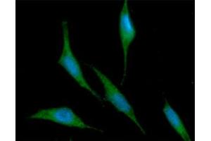 ICC/IF analysis of RNH1 in PC3 cells line, stained with DAPI (Blue) for nucleus staining and monoclonal anti-human RNH1 antibody (1:100) with goat anti-mouse IgG-Alexa fluor 488 conjugate (Green). (RNH1 Antikörper  (AA 7-461))