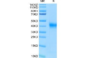 Human FOLR1 on Tris-Bis PAGE under reduced condition. (FOLR1 Protein (AA 25-233) (His-Avi Tag))