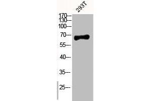 Western Blot analysis of 293T cells using Phospho-p63 (S455) Polyclonal Antibody (p63 Antikörper  (pSer455))