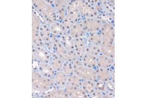 Immunohistochemistry of paraffin-embedded Mouse kidney using MTMR8 Rabbit pAb (ABIN7268766) at dilution of 1:100 (40x lens). (MTMR8 Antikörper  (AA 430-560))