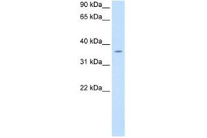 WB Suggested Anti-PON1 Antibody Titration:  0. (PON1 Antikörper  (C-Term))