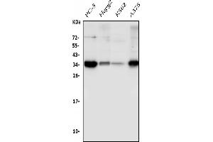 Western blot analysis of Sprouty 4/Spry-4/SPRY4 using anti-Sprouty 4/Spry-4/SPRY4 antibody (ABIN7599232).