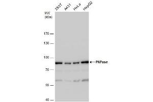 WB Image PNPase antibody detects PNPase protein by western blot analysis. (PNPT1 Antikörper)