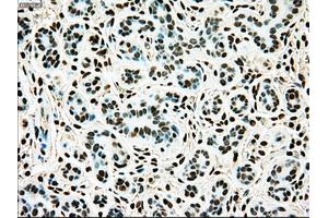Immunohistochemical staining of paraffin-embedded breast tissue using anti-TYRO3 mouse monoclonal antibody. (TYRO3 Antikörper)