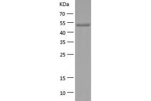 Glutathione Synthetase Protein (GSS) (AA 2-474) (His tag)