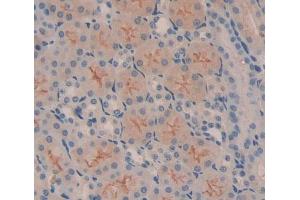 Used in DAB staining on fromalin fixed paraffin- embedded Kidney tissue (Metaxin 1 Antikörper  (AA 70-203))