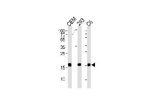 SUMO2 Antibody (C-term) (ABIN1882280 and ABIN2843489) western blot analysis in CEM,293,rat C6 cell line lysates (35 μg/lane).