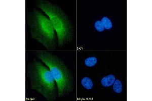 Immunofluorescence staining of fixed HeLa cells with anti-RAP antibody 7F1. (Rekombinanter LRPAP1 Antikörper)