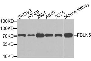 Western blot analysis of extracts of various cell lines, using FBLN5 antibody. (Fibulin 5 Antikörper)