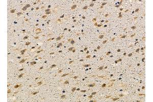 ABIN7095401 and ABIN7099458 at 1/100 staining mouse brain tissue by IHC-P. (PPP1R42 Antikörper)