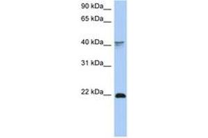 Image no. 1 for anti-Distal-Less Homeobox 4 (DLX4) (C-Term) antibody (ABIN6742745) (DLX4 Antikörper  (C-Term))