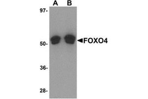 Western blot analysis of FOXO4 in A-20 cell lysate with FOXO4 antibody at (A) 0. (FOXO4 Antikörper  (N-Term))