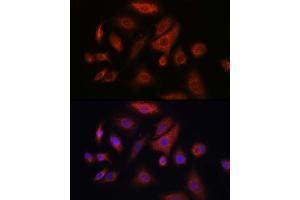 Immunofluorescence (IF) image for anti-R-Spondin 1 (RSPO1) (AA 21-263) antibody (ABIN6147279)
