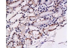 Formalin-fixed and paraffin embedded: rat kidney tissue labeled with Anti-ET-1 Polyclonal Antibody , Unconjugated at 1:200, followed by conjugation to the secondary antibody and DAB staining (Prepro-Endothelin-1 (AA 16-110) Antikörper)