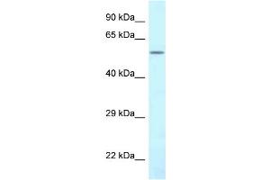WB Suggested Anti-CTPS2 Antibody Titration: 1.