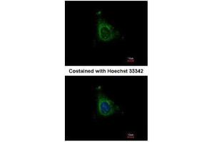 ICC/IF Image Immunofluorescence analysis of methanol-fixed HeLa, using AKAP10, antibody at 1:500 dilution. (AKAP10 Antikörper  (C-Term))