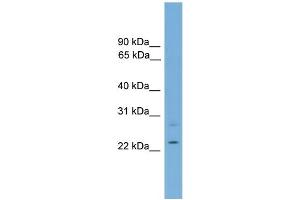 WB Suggested Anti-RBM11 Antibody Titration:  0. (RBM11 Antikörper  (Middle Region))
