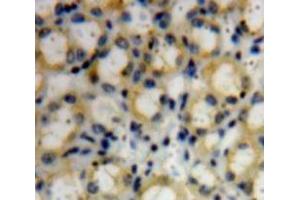 IHC-P analysis of Kidney tissue, with DAB staining. (COL4a3 Antikörper  (AA 1428-1670))