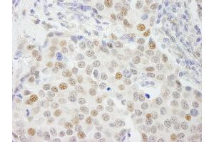 Immunohistochemistry (IHC) image for anti-General Transcription Factor IIIC, Polypeptide 4 (GTF3C4) (AA 625-675) antibody (ABIN7448587) (GTF3C4 Antikörper  (AA 625-675))