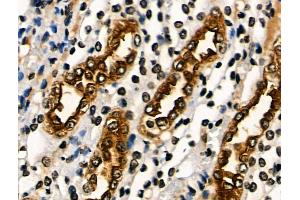 ABIN6265563 and ABIN6266644 at 1/100 staining Rat kidney tissue by IHC-P. (PAR1 Antikörper  (N-Term))