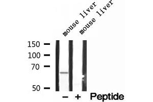 Western blot analysis of extracts of mouse liver tissue, using LARP7 antibody. (LARP7 Antikörper  (C-Term))