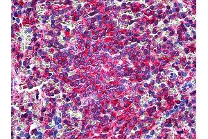 Anti-L Plastin antibody IHC of human spleen. (LCP1 Antikörper  (Headpiece Region))