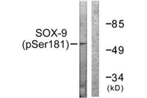 Western blot analysis of extracts from 293 cells treated with PBS 60', using SOX-9 (Phospho-Ser181) Antibody. (SOX9 Antikörper  (pSer181))
