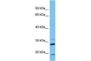 Host:  Mouse  Target Name:  KCNIP2  Sample Tissue:  Mouse Pancreas  Antibody Dilution:  1ug/ml (KCNIP2 Antikörper  (N-Term))