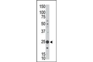 The anti-GEH1 Pab (ABIN390121 and ABIN2840628) is used in Western blot to detect GEH1 in Jurkat cell lysate. (MAGEH1 Antikörper  (C-Term))