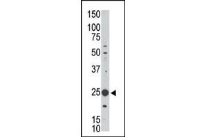 MAGEH1 antibody  (C-Term)