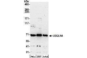 anti-Ubiquilin 4 (UBQLN4) (AA 1-50) antibody