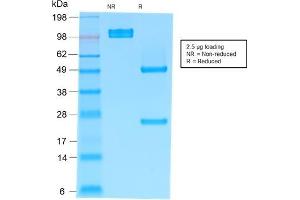 SDS-PAGE Analysis Purified IgM Mouse Recombinant Monoclonal Antibody (rIM373). (Rekombinanter IGHM Antikörper)