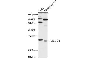 Western blot analysis of extracts of various cell lines, using SN antibody (ABIN7270670) at 1:1000 dilution. (SNAP23 Antikörper  (AA 1-211))