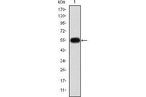 Western blot analysis using MMP9 mAb against human MMP9 (AA: 238-465) recombinant protein. (MMP 9 Antikörper)