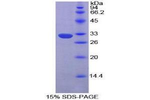 SDS-PAGE (SDS) image for Ephrin Type A Receptor 1 (EPHA1) (AA 716-960) protein (His tag) (ABIN2124735)