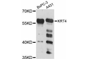 Western blot analysis of extracts of various cell lines, using KRT4 antibody (ABIN5998102) at 1:3000 dilution. (KRT4 Antikörper)