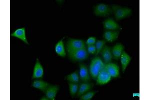 Immunofluorescence staining of Hela cells with ABIN7157186 at 1:50, counter-stained with DAPI. (KALRN Antikörper  (AA 2410-2661))