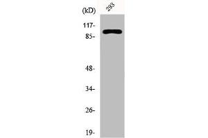 Western Blotting (WB) image for anti-Cadherin 1, Type 1, E-Cadherin (Epithelial) (CDH1) (N-Term) antibody (ABIN7188712)