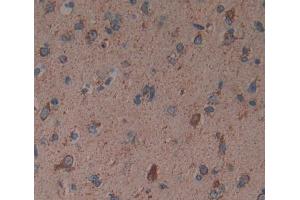 Used in DAB staining on fromalin fixed paraffin- embedded brain tissue (Reticulon 1 Antikörper  (AA 589-776))