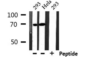 Western blot analysis of extracts from 293 and Hela, using NXF1 Antibody. (NXF1 Antikörper  (N-Term))