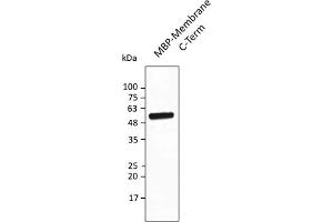 Western Blotting (WB) image for anti-SARS-CoV-2 Membrane Protein (SARS-CoV-2 M) (AA 150-215) antibody (ABIN7273018)