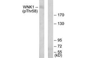 Western blot analysis of extracts from 293 cells treated with EGF 200ng/ml 30', using WNK1 (Phospho-Thr58) Antibody. (WNK1 Antikörper  (pThr60))