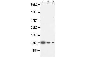 Anti-IL-4 antibody, Western blotting Lane 1: Recombinant Human IL-4 Protein 10ng Lane 2: Recombinant Human IL-4 Protein 5ng Lane 3: Recombinant Human IL-4 Protein 2. (IL-4 Antikörper  (Middle Region))